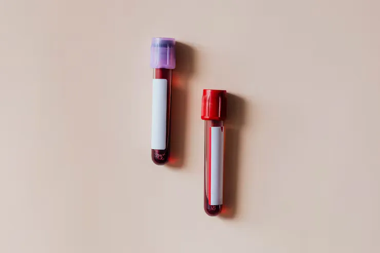 گروه خونی طلایی چیست؟ کمیاب‌ترین گروه خونی