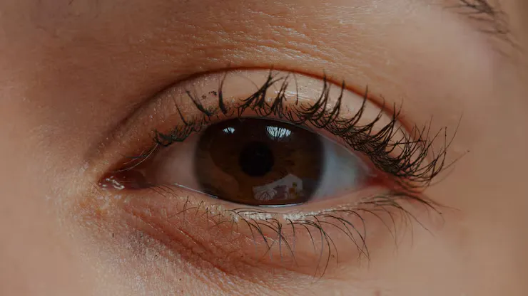 علت پریدن پلک چشم و پرش پلک: درمان و راهکارها 1 علت پریدن پلک چشم و پرش پلک: درمان و راهکارها