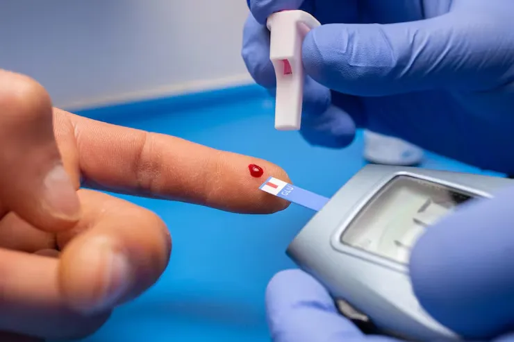 قند خون چیست؟ آزمایش قند خون، کنترل و تفسیر 1 closeup shot doctor with rubber gloves taking blood test from patient 181624 56107 4 11zon